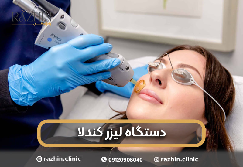 لیزر کندلا کلینیک راژین