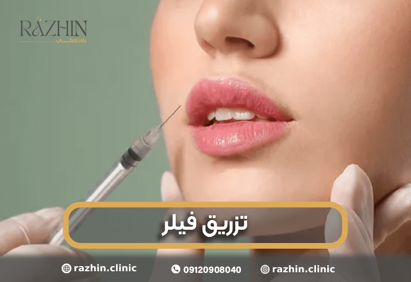 تزریق فیلر