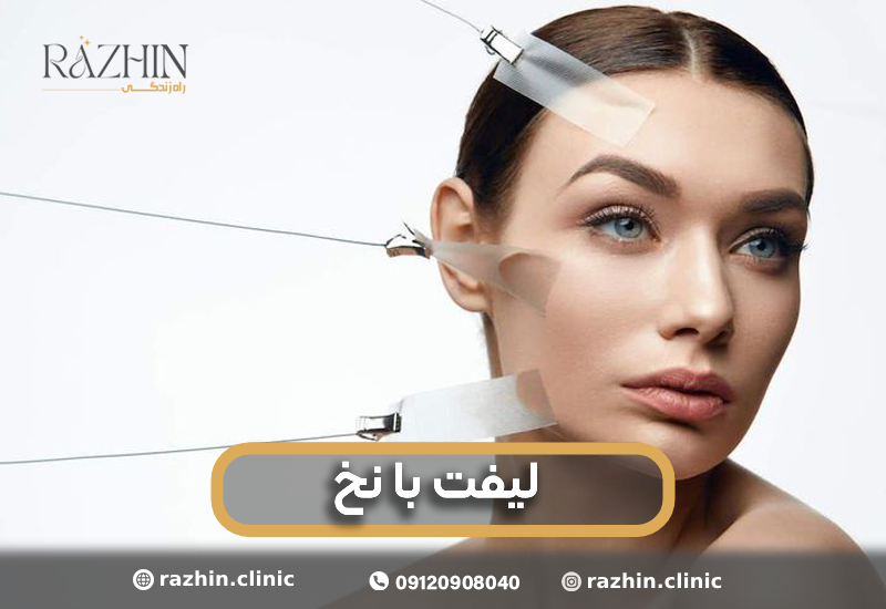 لیفت با نخ راژین کلینیک