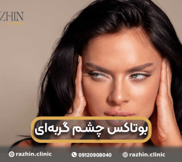 بوتاکس چشم گربه ای