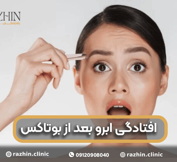 افتادگی ابرو