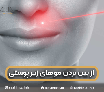 از بین بردن موهای زیر پوستی