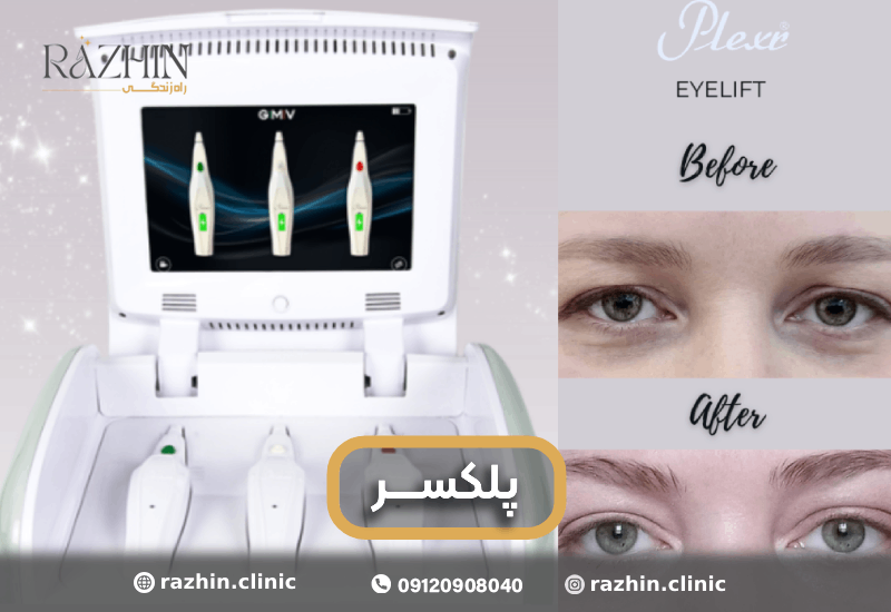 دستگاه پلکسر کلینیک راژین