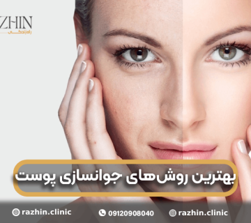 جوانسازی پوست کلینیک راژین