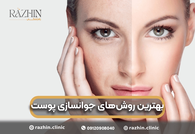 جوانسازی پوست کلینیک راژین
