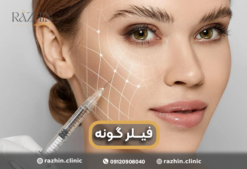 تزریق فیلر گونه در کلینیک راژین