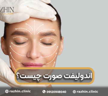 اندولیفت صورت چیست؟