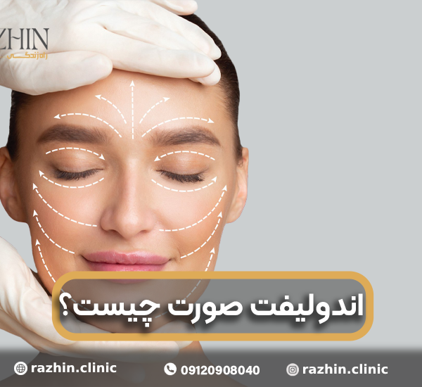 اندولیفت صورت چیست؟
