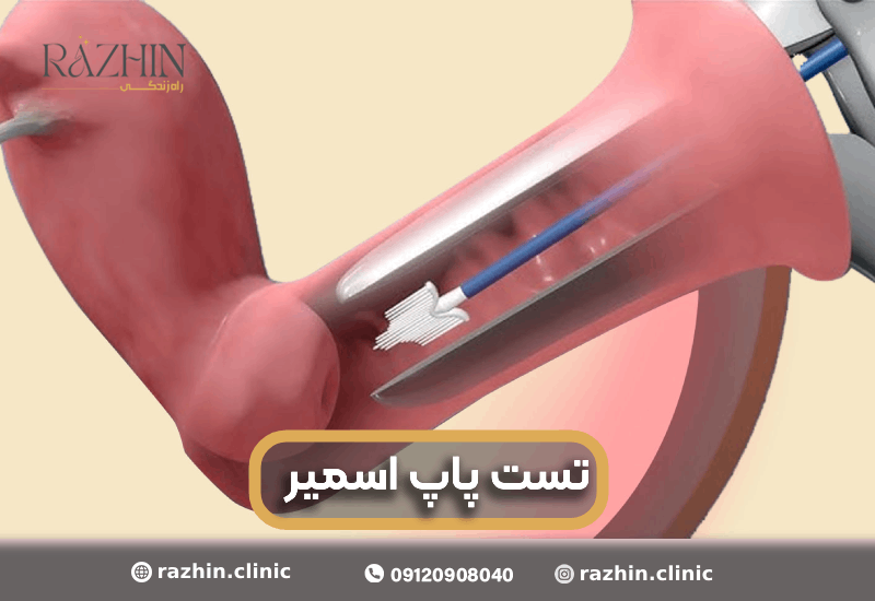 تست پاپ اسمیر
