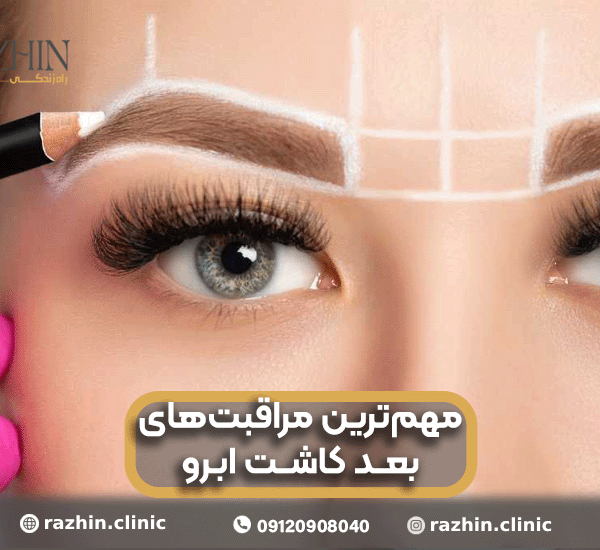 مراقبت های بعد از کاشت ابرو