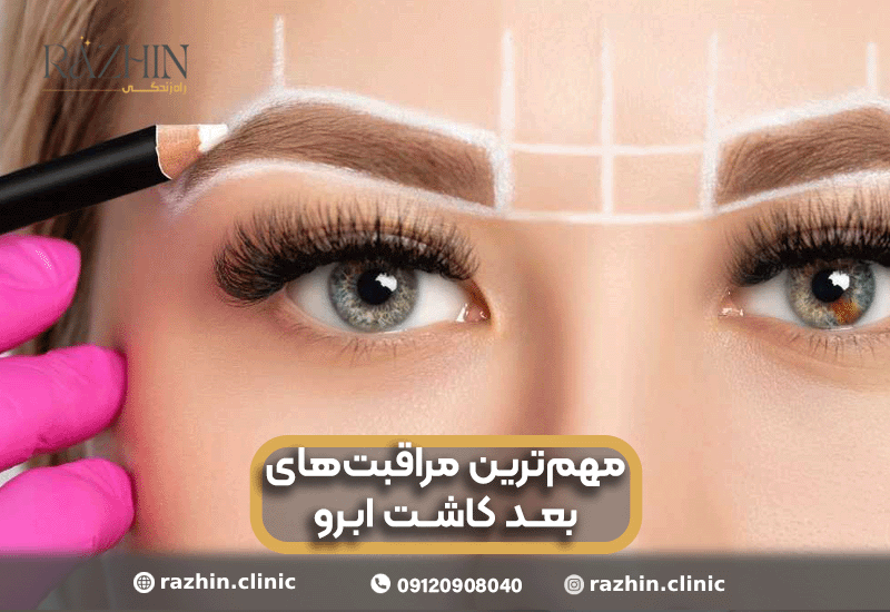 مراقبت های بعد از کاشت ابرو