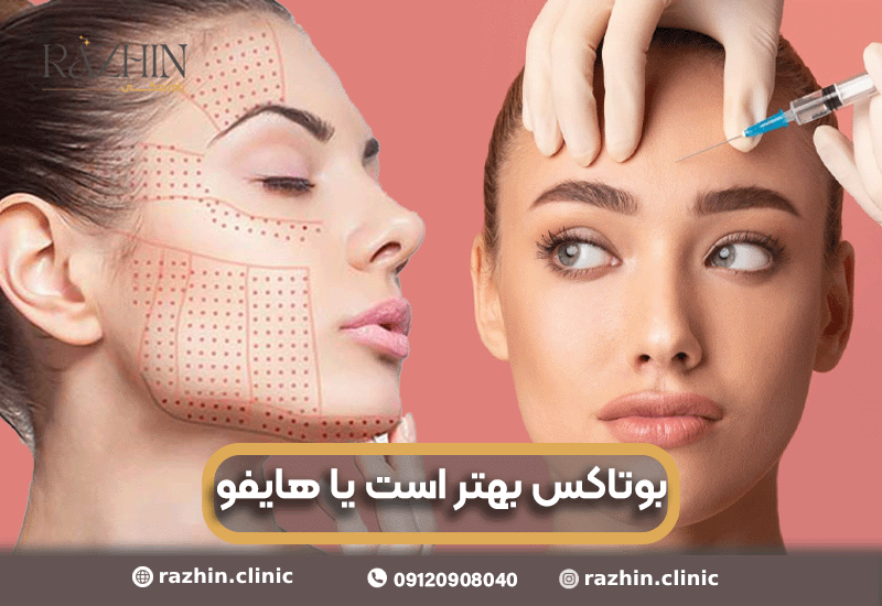 هایفو بهتر است یا بوتاکس