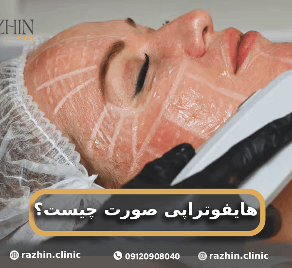 هایفوتراپی صورت کلینیک راژین