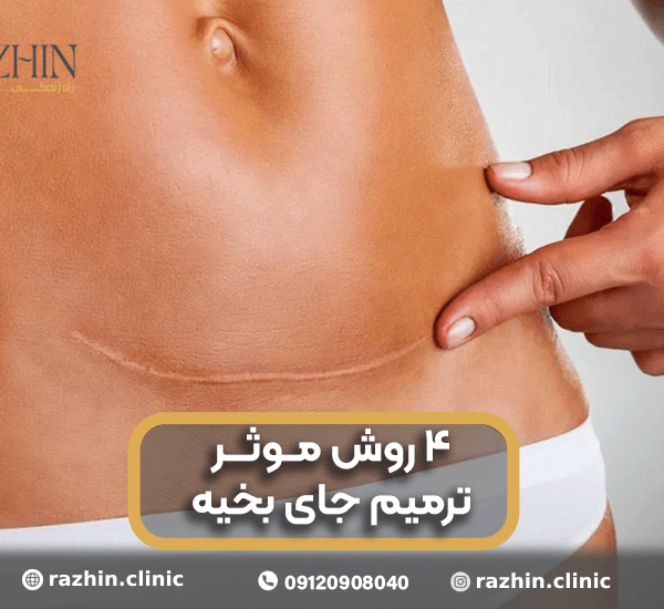 ترمیم جای بخیه