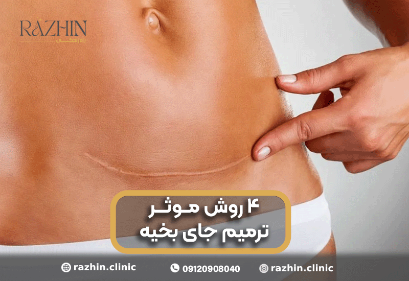 ترمیم جای بخیه