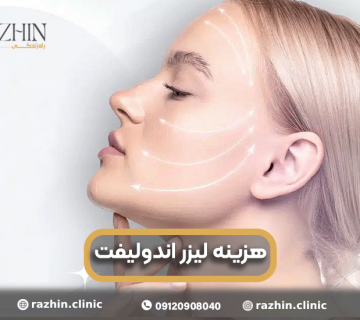 هزینه اندولیفت