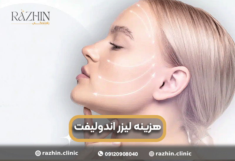 هزینه اندولیفت