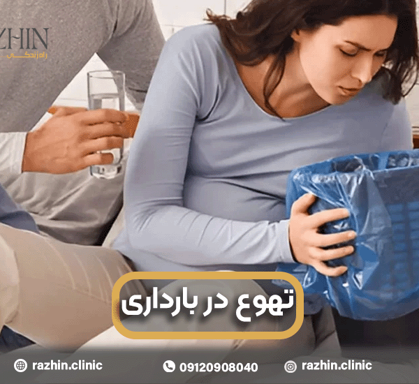 تهوع در بارداری
