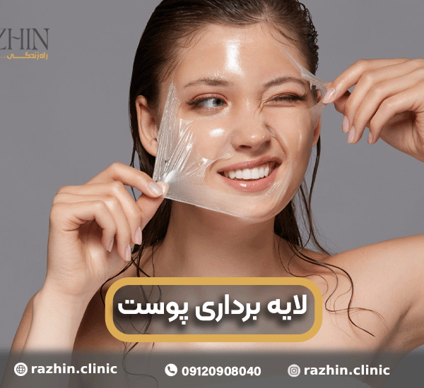 لایه برداری پوست