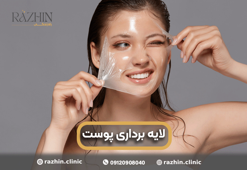 لایه برداری پوست