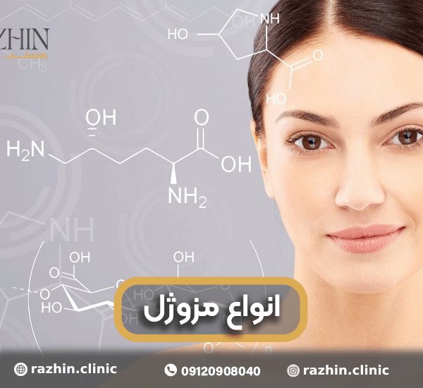 انواع مزوژل