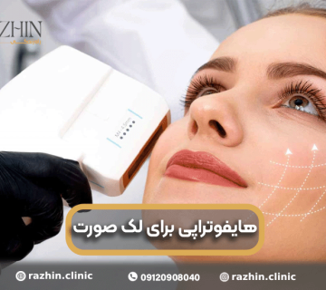 هایفوتراپی برای لک صورت