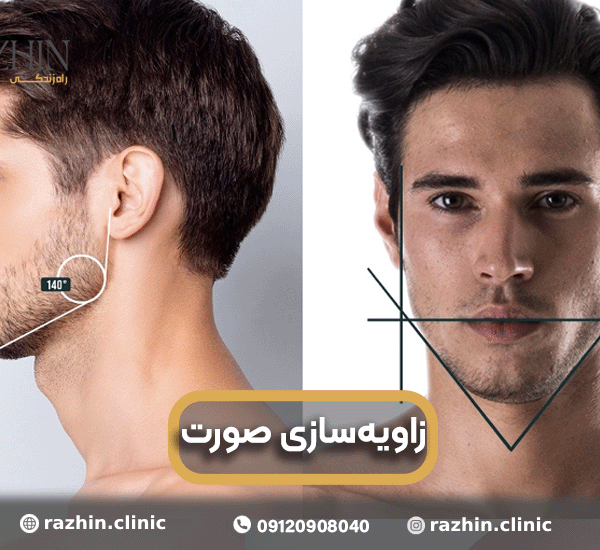 زاویه سازی صورت