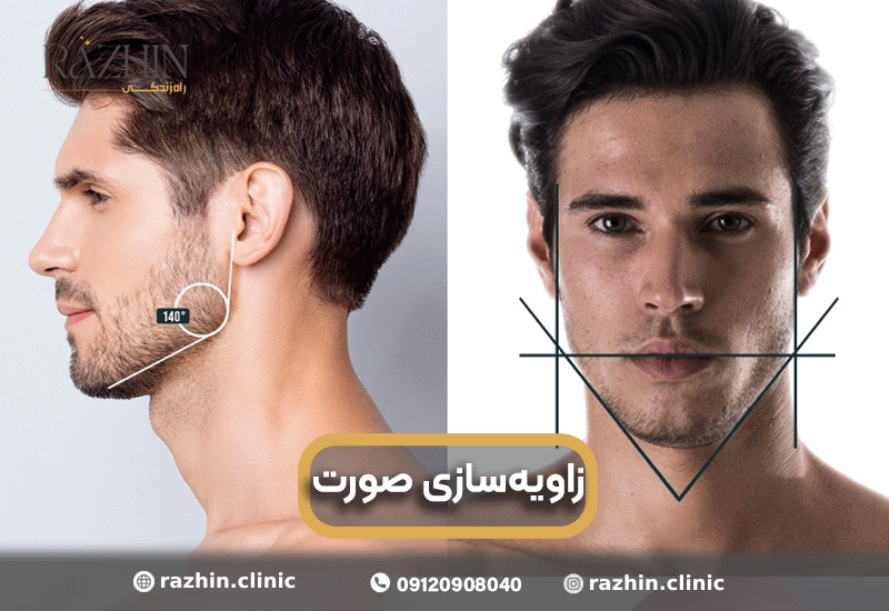 زاویه سازی صورت