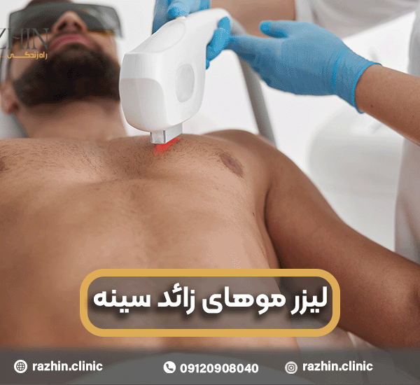 لیزر موهای زائد سینه