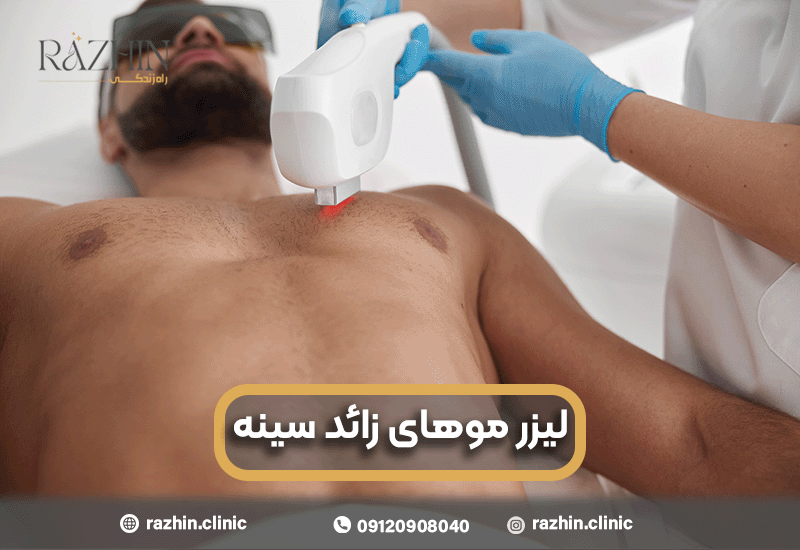لیزر موهای زائد سینه