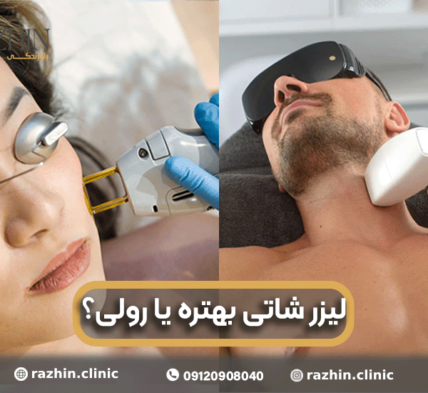 لیزر شاتی بهتر است یا رولی؟
