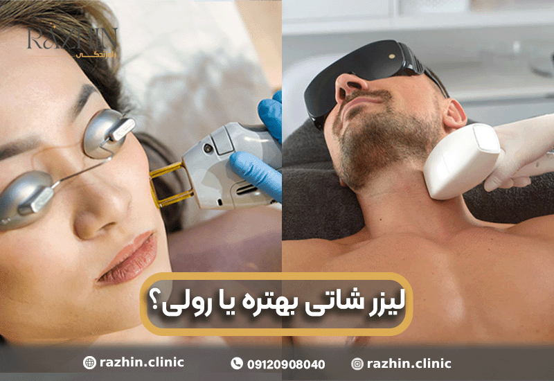 لیزر شاتی بهتر است یا رولی؟
