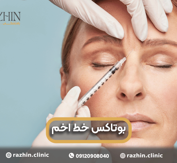 بوتاکس خط اخم در کلینیک راژین