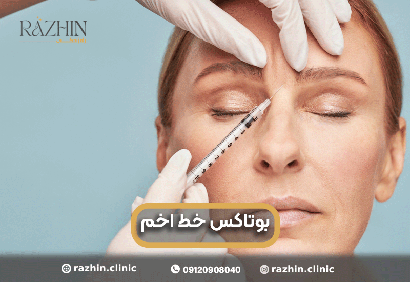 بوتاکس خط اخم در کلینیک راژین