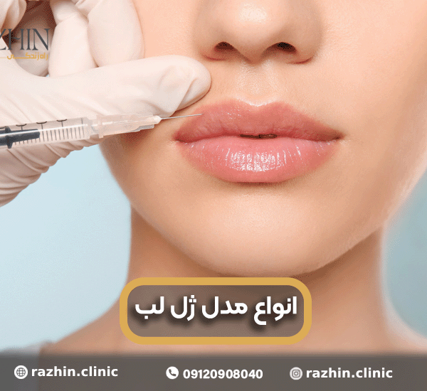 انواع مدل ژل لب