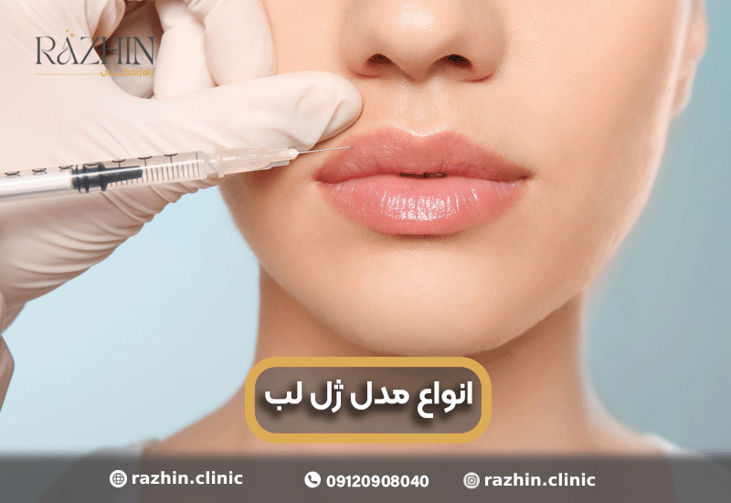 انواع مدل ژل لب