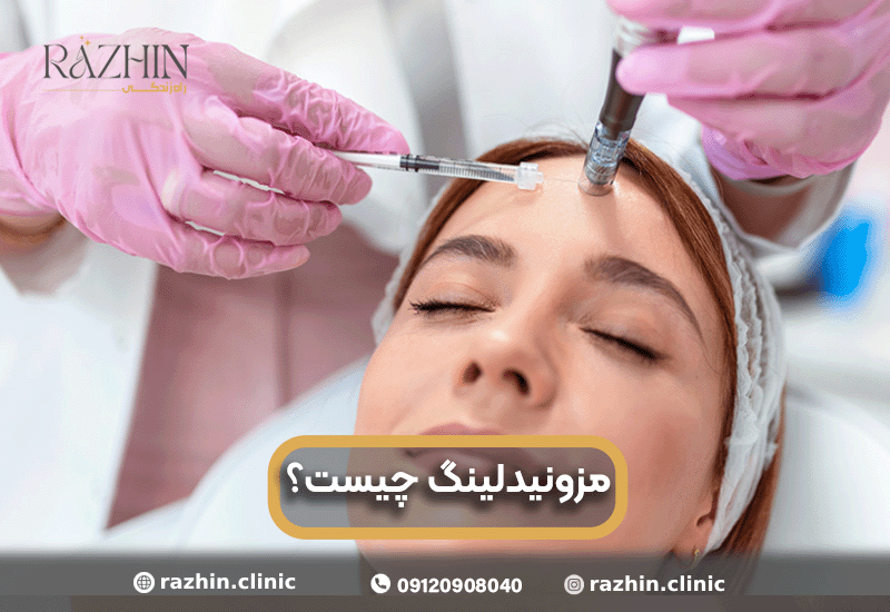 مزونیدلینگ