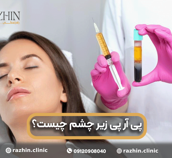 پی آر پی زیر چشم