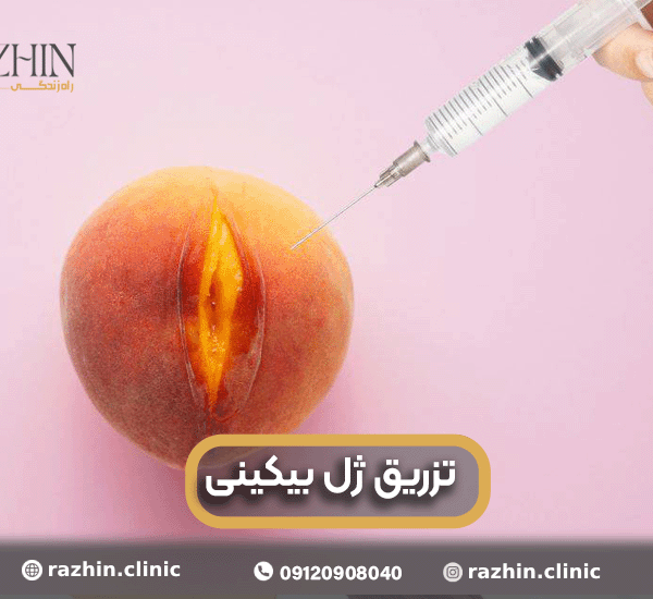 تزریق ژل بیکینی