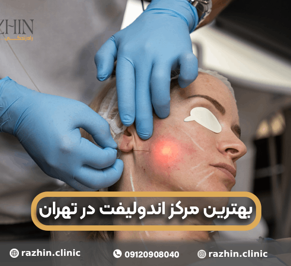 بهترین مرکز اندولیفت در تهران