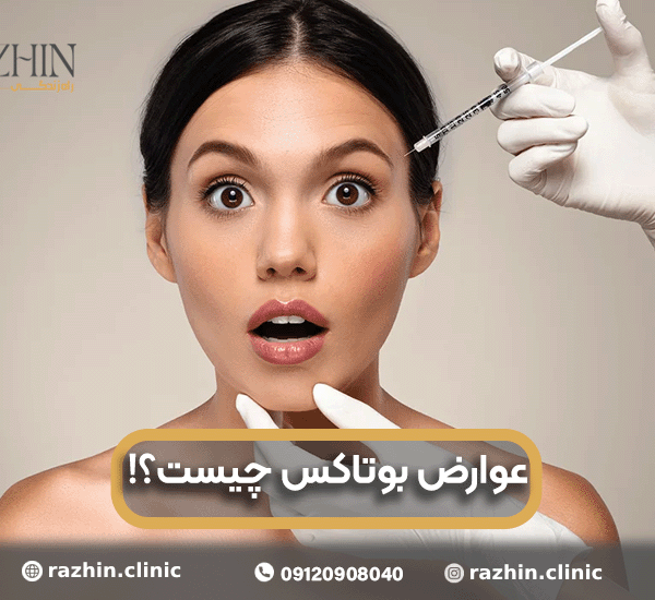 عوارض بوتاکس