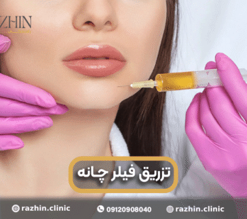 تزریق ژل چانه