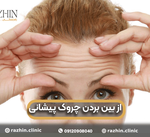 از بین بردن چروک پیشانی