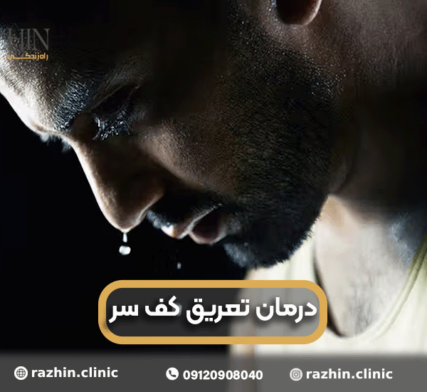 درمان تعریق کف سر در کلینیک راژین