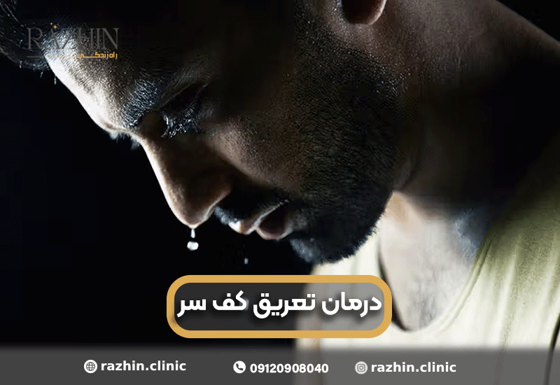 درمان تعریق کف سر در کلینیک راژین