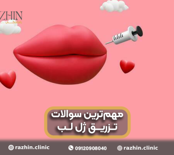 تزریق ژل لب