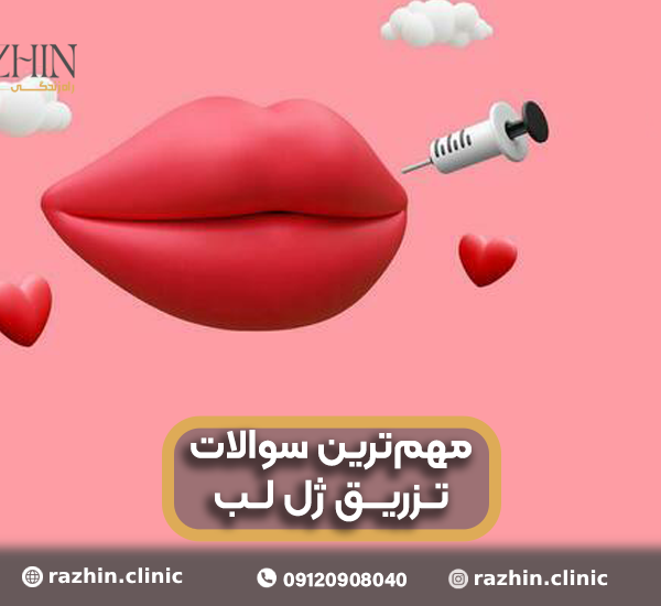 تزریق ژل لب