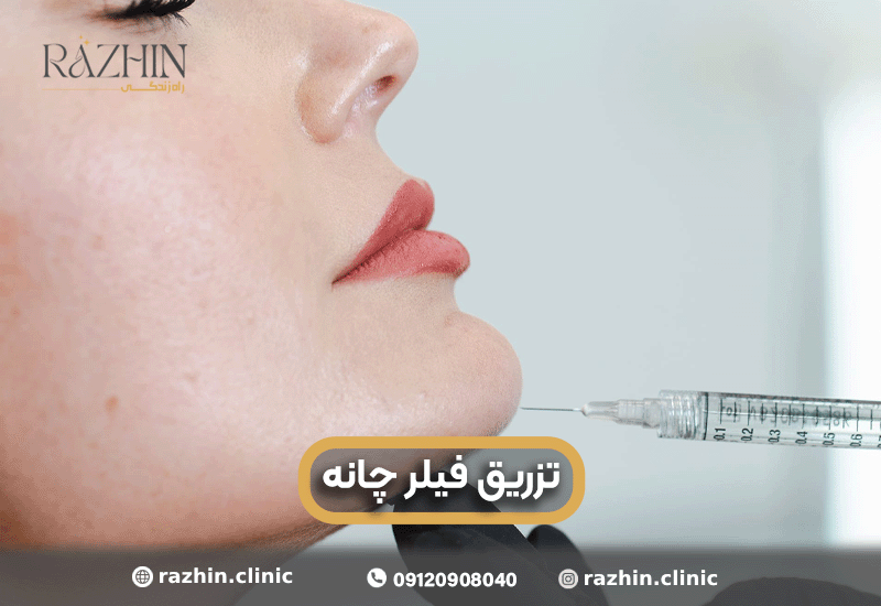 تزریق فیلر چانه