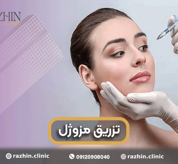 تزریق مزوژل