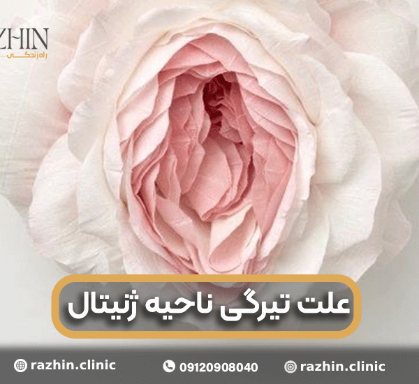 علت تیرگی ناحیه ژنیتال